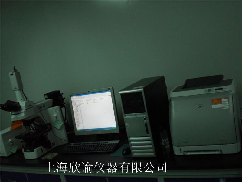 染色體分析系統(tǒng)XY-RS-A,欣諭染色體圖像分析系統(tǒng)，核型圖像分析系統(tǒng)